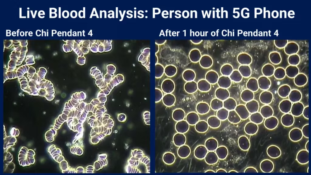 Live blood analysis Before and After Amezcua use
